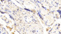 DAB staining on IHC-P; Samples: Human Placenta Tissue;  Primary Ab: 20μg/ml Rabbit Anti-Human HSP90aB1 Antibody Second Ab: 2µg/mL HRP-Linked Caprine Anti-Rabbit IgG Polyclonal Antibody  DAB staining on IHC-P; Samples: Human Placenta Tissue;  Primary Ab: 20μg/ml Rabbit Anti-Human HSP90aB1 Antibody Second Ab: 2µg/mL HRP-Linked Caprine Anti-Rabbit IgG Polyclonal Antibody