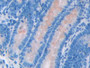 DAB staining on IHC-P; Samples: Rat Small intestine Tissue; Primary Ab: 20µg/ml Rabbit Anti-Rat SPA2 Antibody Second Ab: 2µg/mL HRP-Linked Caprine Anti-Rabbit IgG Polyclonal Antibody DAB staining on IHC-P; Samples: Rat Small intestine Tissue; Primary Ab: 20µg/ml Rabbit Anti-Rat SPA2 Antibody Second Ab: 2µg/mL HRP-Linked Caprine Anti-Rabbit IgG Polyclonal Antibody