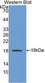 Western Blot; Sample: Recombinant protein. Western Blot; Sample: Recombinant protein.