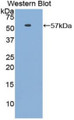 Western Blot; Sample: Recombinant protein. Western Blot; Sample: Recombinant protein.