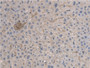 DAB staining on IHC-P; Samples: Rat Liver Tissue; Primary Ab: 20µg/ml Rabbit Anti-Rat ARNTL Antibody Second Ab: 2µg/mL HRP-Linked Caprine Anti-Rabbit IgG Polyclonal Antibody DAB staining on IHC-P; Samples: Rat Liver Tissue; Primary Ab: 20µg/ml Rabbit Anti-Rat ARNTL Antibody Second Ab: 2µg/mL HRP-Linked Caprine Anti-Rabbit IgG Polyclonal Antibody