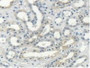 DAB staining on IHC-P; Samples: Human Kidney Tissue. DAB staining on IHC-P; Samples: Human Kidney Tissue.