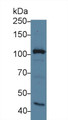Western Blot; Sample: Mouse Spleen lysate; Primary Ab: 2µg/ml Rabbit Anti-Mouse MYO1G Antibody Second Ab: 0.2µg/mL HRP-Linked Caprine Anti-Rabbit IgG Polyclonal Antibody Western Blot; Sample: Mouse Spleen lysate; Primary Ab: 2µg/ml Rabbit Anti-Mouse MYO1G Antibody Second Ab: 0.2µg/mL HRP-Linked Caprine Anti-Rabbit IgG Polyclonal Antibody