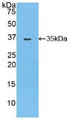 Western Blot; Sample: Recombinant MYO1D, Rat. Western Blot; Sample: Recombinant MYO1D, Rat.
