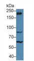 Western Blot; Sample: Mouse Cerebrum lysate; Primary Ab: 5µg/ml Rabbit Anti-Human MYH10 Antibody Second Ab: 0.2µg/mL HRP-Linked Caprine Anti-Rabbit IgG Polyclonal Antibody Western Blot; Sample: Mouse Cerebrum lysate; Primary Ab: 5µg/ml Rabbit Anti-Human MYH10 Antibody Second Ab: 0.2µg/mL HRP-Linked Caprine Anti-Rabbit IgG Polyclonal Antibody