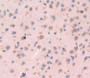 Myosin Heavy Chain 4, Skeletal Muscle (MYH4) Polyclonal Antibody, Cat#CAU23357 Myosin Heavy Chain 4, Skeletal Muscle (MYH4) Polyclonal Antibody, Cat#CAU23357