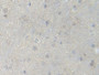 DAB staining on IHC-P; Samples: Rat Spinal cord Tissue; Primary Ab: 10µg/ml Rabbit Anti-Rat PFKM Antibody Second Ab: 2µg/mL HRP-Linked Caprine Anti-Rabbit IgG Polyclonal Antibody