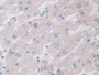 DAB staining on IHC-P; Samples: Human Liver Tissue; Primary Ab: 10µg/ml Rabbit Anti-Human Maspin Antibody Second Ab: 2µg/mL HRP-Linked Caprine Anti-Rabbit IgG Polyclonal Antibody DAB staining on IHC-P; Samples: Human Liver Tissue; Primary Ab: 10µg/ml Rabbit Anti-Human Maspin Antibody Second Ab: 2µg/mL HRP-Linked Caprine Anti-Rabbit IgG Polyclonal Antibody