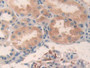 DAB staining on IHC-P; Samples: Human Kidney Tissue DAB staining on IHC-P; Samples: Human Kidney Tissue