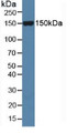 Western Blot; Sample: Mouse Serum. Western Blot; Sample: Mouse Serum.