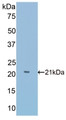 Western Blot; Sample: Recombinant Slit1, Mouse. Western Blot; Sample: Recombinant Slit1, Mouse.