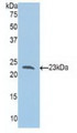 Western Blot; Sample: Recombinant Slit1, Human. Western Blot; Sample: Recombinant Slit1, Human.