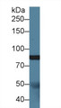 Western Blot; Sample: Porcine Cerebrum lysate; ; Primary Ab: 1.5µg/ml Rabbit Anti-Human Slit1 Antibody; Second Ab: 0.2µg/mL HRP-Linked Caprine Anti-Rabbit IgG Polyclonal Antibody; Western Blot; Sample: Porcine Cerebrum lysate; ; Primary Ab: 1.5µg/ml Rabbit Anti-Human Slit1 Antibody; Second Ab: 0.2µg/mL HRP-Linked Caprine Anti-Rabbit IgG Polyclonal Antibody;