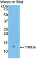 Western Blot; Sample: Recombinant protein. Western Blot; Sample: Recombinant protein.