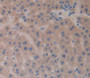 Slit Homolog 3 (Slit3) Polyclonal Antibody, Cat#CAU23397 Slit Homolog 3 (Slit3) Polyclonal Antibody, Cat#CAU23397