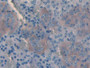 DAB staining on IHC-P; Samples: Rat Adrenal gland Tissue; Primary Ab: 20µg/ml Rabbit Anti-Rat Slit3 Antibody Second Ab: 2µg/mL HRP-Linked Caprine Anti-Rabbit IgG Polyclonal Antibody DAB staining on IHC-P; Samples: Rat Adrenal gland Tissue; Primary Ab: 20µg/ml Rabbit Anti-Rat Slit3 Antibody Second Ab: 2µg/mL HRP-Linked Caprine Anti-Rabbit IgG Polyclonal Antibody