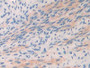 DAB staining on IHC-P; Samples: Mouse Oviduct Tissue; Primary Ab: 30µg/ml Rabbit Anti-Mouse COL2a1 Antibody Second Ab: 2µg/mL HRP-Linked Caprine Anti-Rabbit IgG Polyclonal Antibody