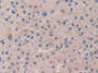 DAB staining on fromalin fixed paraffin-embedded Kidney tissue) DAB staining on fromalin fixed paraffin-embedded Kidney tissue)