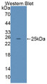 Western Blot; Sample: Recombinant protein. Western Blot; Sample: Recombinant protein.
