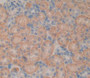 Low Density Lipoprotein Receptor Related Protein Associated Protein 1 (LRPAP1) Polyclonal Antibody, Cat#CAU23573
