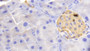 DAB staining on IHC-P; Samples: Mouse Pancreas Tissue; Primary Ab: 20μg/ml Rabbit Anti-Mouse HBb Antibody Second Ab: 2µg/mL HRP-Linked Caprine Anti-Rabbit IgG Polyclonal Antibody DAB staining on IHC-P; Samples: Mouse Pancreas Tissue; Primary Ab: 20μg/ml Rabbit Anti-Mouse HBb Antibody Second Ab: 2µg/mL HRP-Linked Caprine Anti-Rabbit IgG Polyclonal Antibody