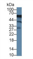 Western Blot; Sample: Human K562 cell lysate; Primary Ab: 1µg/ml Rabbit Anti-Mouse ACP6 Antibody Second Ab: 0.2µg/mL HRP-Linked Caprine Anti-Rabbit IgG Polyclonal Antibody Western Blot; Sample: Human K562 cell lysate; Primary Ab: 1µg/ml Rabbit Anti-Mouse ACP6 Antibody Second Ab: 0.2µg/mL HRP-Linked Caprine Anti-Rabbit IgG Polyclonal Antibody