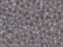 DAB staining on IHC-P; Samples: Mouse Liver Tissue DAB staining on IHC-P; Samples: Mouse Liver Tissue