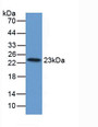 Western Blot; Sample: Bovine Liver Tissue. Western Blot; Sample: Bovine Liver Tissue.