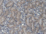 DAB staining on IHC-P; Samples: Mouse Kidney Tissue;  Primary Ab: 20µg/ml Rabbit Anti-Mouse EPRS Ant