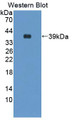 Western Blot; Sample: Recombinant protein. Western Blot; Sample: Recombinant protein.