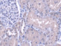 DAB staining on IHC-P; Samples: Human Kidney Tissue; Primary Ab: 20µg/ml Rabbit Anti-Human CTSH Antibody Second Ab: 2µg/mL HRP-Linked Caprine Anti-Rabbit IgG Polyclonal Antibody DAB staining on IHC-P; Samples: Human Kidney Tissue; Primary Ab: 20µg/ml Rabbit Anti-Human CTSH Antibody Second Ab: 2µg/mL HRP-Linked Caprine Anti-Rabbit IgG Polyclonal Antibody
