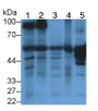 Western Blot; Sample: Lane1: Mouse Cerebrum lysate; Lane2: Mouse Cerebellum lysate; Lane3: Rat Cerebrum lysate; Lane4: Rat Cerebellum lysate; Lane5: Porcine Cerebrum lysate; Primary Ab: 5μg/ml Rabbit Anti-Mouse GAD1 Antibody; Second Ab: 0.2µg/mL HRP-Linked Caprine Anti-Rabbit IgG Polyclonal Antibody; Western Blot; Sample: Lane1: Mouse Cerebrum lysate; Lane2: Mouse Cerebellum lysate; Lane3: Rat Cerebrum lysate; Lane4: Rat Cerebellum lysate; Lane5: Porcine Cerebrum lysate; Primary Ab: 5μg/ml Rabbit Anti-Mouse GAD1 Antibody; Second Ab: 0.2µg/mL HRP-Linked Caprine Anti-Rabbit IgG Polyclonal Antibody;