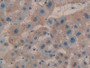 DAB staining on fromalin fixed paraffin- embedded liver tissue) DAB staining on fromalin fixed paraffin- embedded liver tissue)