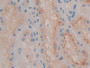 DAB staining on IHC-P; Samples: Human Kidney Tissue; Primary Ab: 10µg/ml Rabbit Anti-Human QSOX1 Antibody Second Ab: 2µg/mL HRP-Linked Caprine Anti-Rabbit IgG Polyclonal Antibody DAB staining on IHC-P; Samples: Human Kidney Tissue; Primary Ab: 10µg/ml Rabbit Anti-Human QSOX1 Antibody Second Ab: 2µg/mL HRP-Linked Caprine Anti-Rabbit IgG Polyclonal Antibody