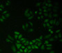 FITC staining on IHC-P; Samples: Human Hela Cells FITC staining on IHC-P; Samples: Human Hela Cells