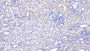 DAB staining on fromalin fixed paraffin- embedded Kidney tissue) DAB staining on fromalin fixed paraffin- embedded Kidney tissue)