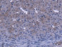 DAB staining on IHC-P; Samples: Mouse Ovary Tissue) DAB staining on IHC-P; Samples: Mouse Ovary Tissue)