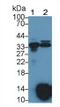 Western Blot; Sample: Lane1: Rat Lung lysate; Lane2: Rat Heart lysate; Primary Ab: 1µg/ml Rabbit Anti-Rat OGN Antibody; Second Ab: 0.2µg/mL HRP-Linked Caprine Anti-Rabbit IgG Polyclonal Antibody; Western Blot; Sample: Lane1: Rat Lung lysate; Lane2: Rat Heart lysate; Primary Ab: 1µg/ml Rabbit Anti-Rat OGN Antibody; Second Ab: 0.2µg/mL HRP-Linked Caprine Anti-Rabbit IgG Polyclonal Antibody;