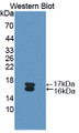Western Blot; Sample: Recombinant protein.