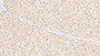 DAB staining on IHC-P; Samples: Human Liver Tissue;  Primary Ab: 20μg/ml Rabbit Anti-Human OGN Antibody Second Ab: 2µg/mL HRP-Linked Caprine Anti-Rabbit IgG Polyclonal Antibody 