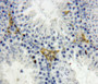 DAB staining on fromalin fixed paraffin-embedded testis tissue)