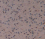 Used in DAB staining on fromalin fixed paraffin- embedded Kidney tissue