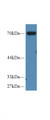 Western Blot; Sample: Porcine Pancreas lysate; Primary Ab: 2µg/ml Rabbit Anti-Human MSN Antibody Second Ab: 0.2µg/mL HRP-Linked Caprine Anti-Rabbit IgG Polyclonal Antibody Western Blot; Sample: Porcine Pancreas lysate; Primary Ab: 2µg/ml Rabbit Anti-Human MSN Antibody Second Ab: 0.2µg/mL HRP-Linked Caprine Anti-Rabbit IgG Polyclonal Antibody