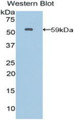 Western Blot; Sample: Recombinant protein. Western Blot; Sample: Recombinant protein.
