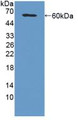 Western Blot; Sample: Recombinant MFAP2, Mouse. Western Blot; Sample: Recombinant MFAP2, Mouse.
