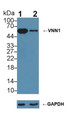 Knockout Varification: <br/>Lane 1: Wild-type BXPC-3 cell lysate; <br/>Lane 2: VNN1 knockout BXPC-3 cell lysate; <br/>Predicted MW: 57kDa <br/>Observed MW: 57kDa<br/>Primary Ab: 3µg/ml Rabbit Anti-Human VNN1 Antibody<br/>Second Ab: 0.2µg/mL HRP-Linked Caprine Anti-Rabbit IgG Polyclonal Antibody<br/> Knockout Varification: <br/>Lane 1: Wild-type BXPC-3 cell lysate; <br/>Lane 2: VNN1 knockout BXPC-3 cell lysate; <br/>Predicted MW: 57kDa <br/>Observed MW: 57kDa<br/>Primary Ab: 3µg/ml Rabbit Anti-Human VNN1 Antibody<br/>Second Ab: 0.2µg/mL HRP-Linked Caprine Anti-Rabbit IgG Polyclonal Antibody<br/>