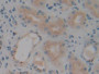 DAB staining on IHC-P; Samples: Human Kidney Tissue; Primary Ab: 10µg/ml Rabbit Anti-Human VNN1 Antibody Second Ab: 2µg/mL HRP-Linked Caprine Anti-Rabbit IgG Polyclonal Antibody DAB staining on IHC-P; Samples: Human Kidney Tissue; Primary Ab: 10µg/ml Rabbit Anti-Human VNN1 Antibody Second Ab: 2µg/mL HRP-Linked Caprine Anti-Rabbit IgG Polyclonal Antibody