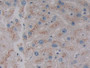 DAB staining on IHC-P; Samples: Human Liver Tissue. DAB staining on IHC-P; Samples: Human Liver Tissue.