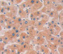 Used in DAB staining on fromalin fixed paraffin- embedded Kidney tissue