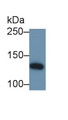 Western Blot; Sample: Bovine Cerebrum lysate; Primary Ab: 0.2µg/ml Rabbit Anti-Mouse IRS1 Antibody; Second Ab: 0.2µg/mL HRP-Linked Caprine Anti-Rabbit IgG Polyclonal Antibody; Western Blot; Sample: Bovine Cerebrum lysate; Primary Ab: 0.2µg/ml Rabbit Anti-Mouse IRS1 Antibody; Second Ab: 0.2µg/mL HRP-Linked Caprine Anti-Rabbit IgG Polyclonal Antibody;